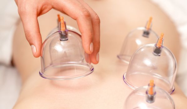 Få cupping i Silkeborg af dygtig lægeeksamineret fysiurgisk Massør med 16 års erfaring